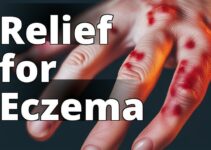 Discover The Remarkable Benefits Of Cbd Oil For Eczema: Your Ultimate Soothing Solution