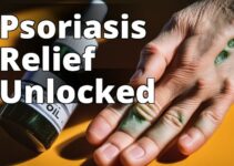 Discover The Miraculous Benefits Of Cbd Oil For Psoriasis Treatment